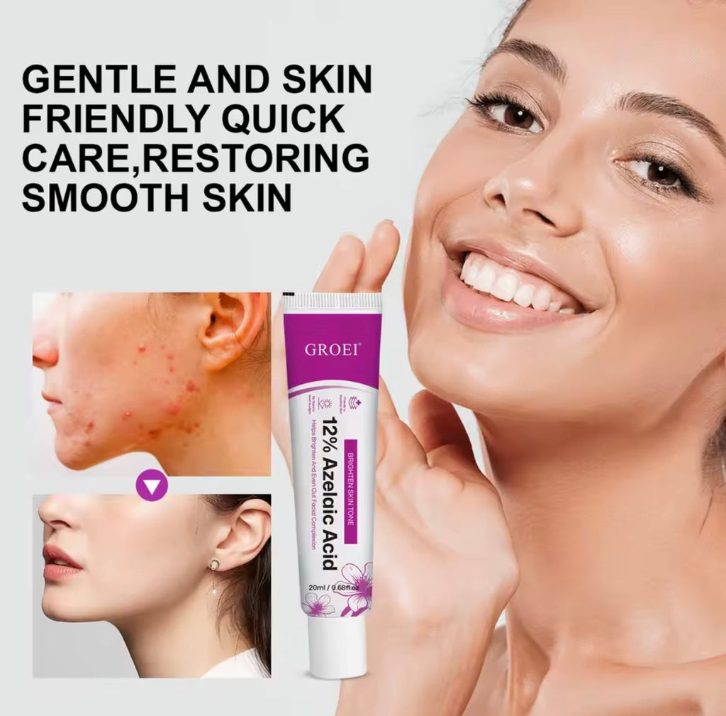 Groei 12% Azelaic Acid Cream – Brightening and Even-Tone Facial Treatment