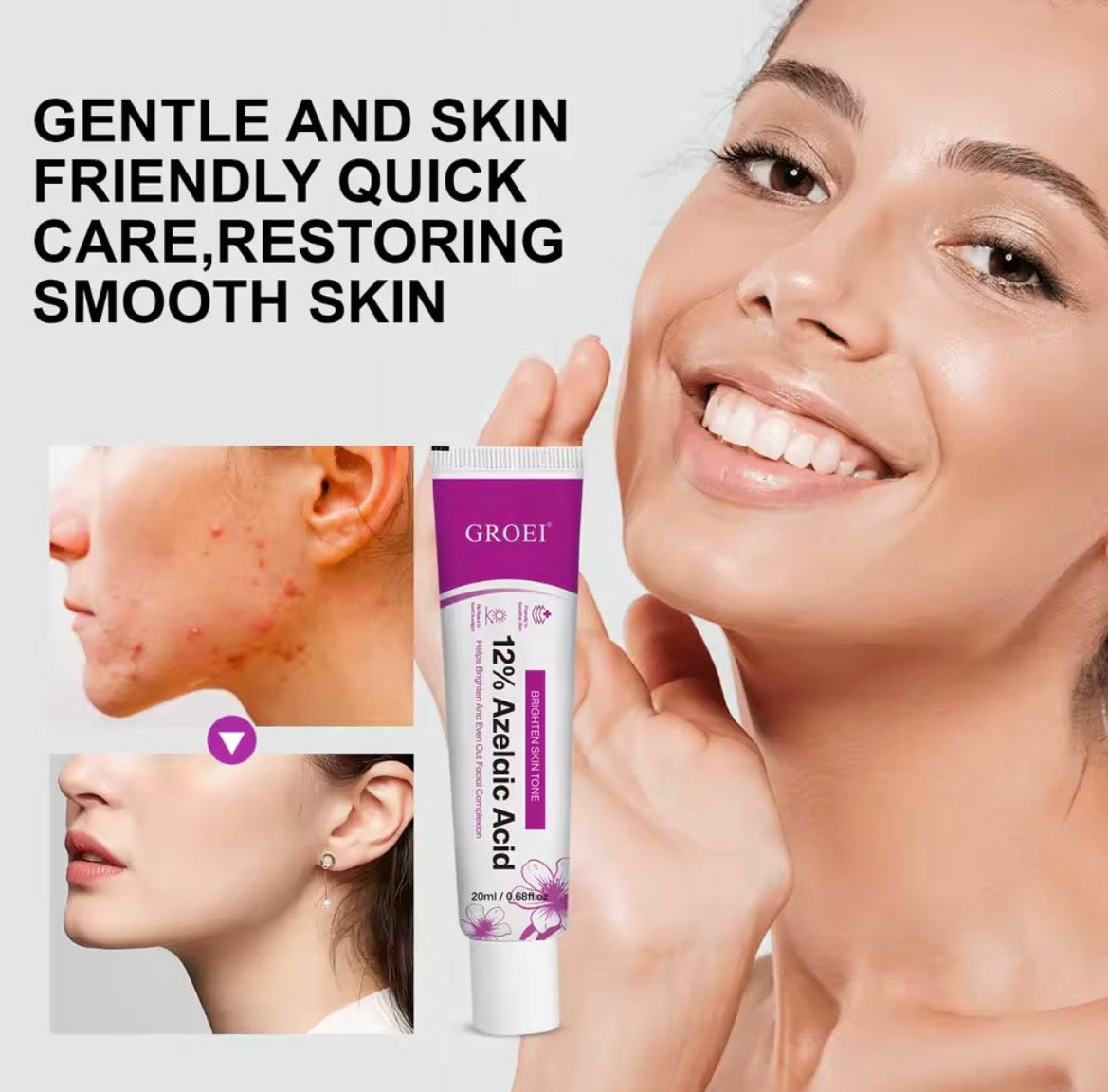 Groei 12% Azelaic Acid Cream – Brightening and Even-Tone Facial Treatment